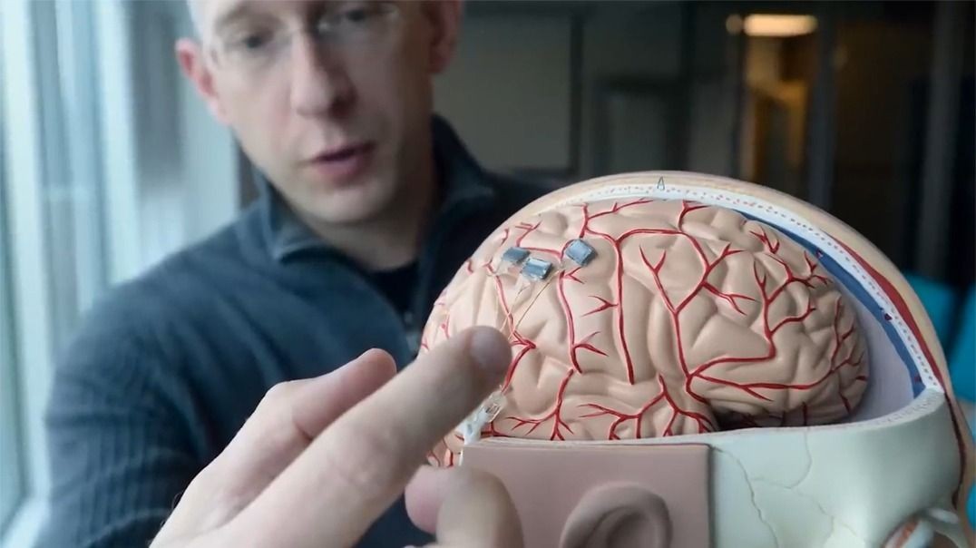 New Brain Implant Begins Human Trials